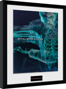 Рамкиран плакат Metal Gear Solid V - X-Ray