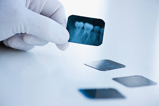 Sticker Dental x-ray