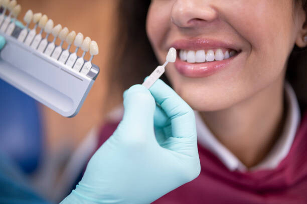 Sticker Dentist using a palette tooth color sample.