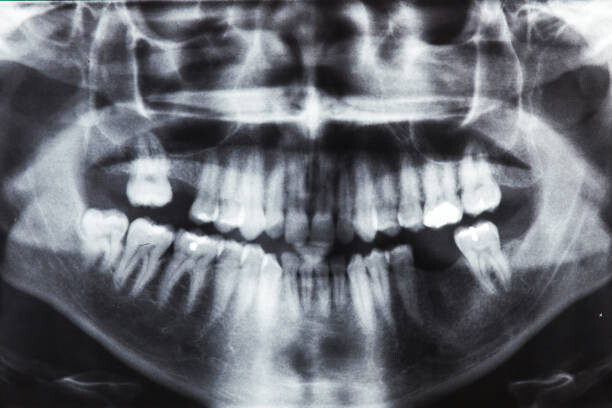 Αφίσα Closeup x-ray image of teeth and mouth